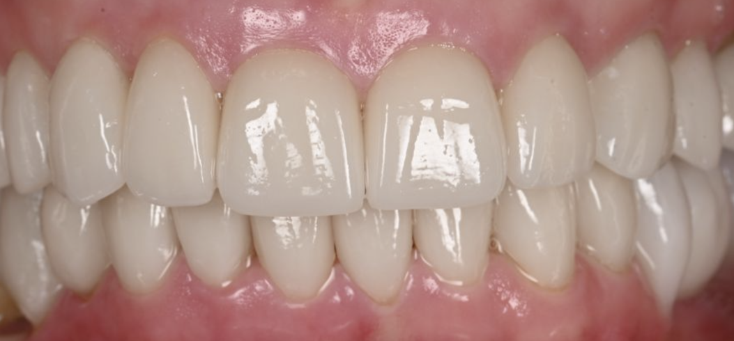 Close-up of a natural smile